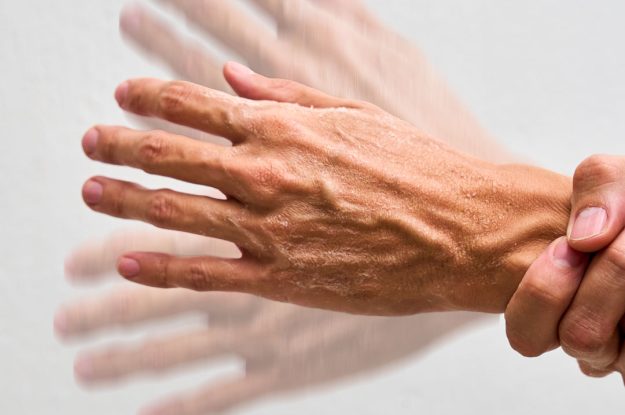 PARKINSON’S EUROPE CONTRO LA “CATTIVA SEMPLIFICAZIONE”