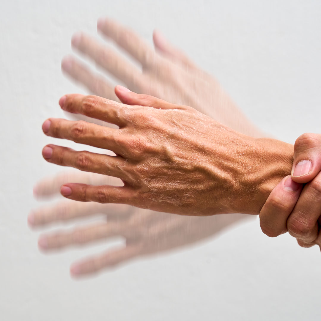 Parkinson e pesticidi: Parkinson's Europe chiede all'UE di mantenere le revisioni periodiche sulla sicurezza dei prodotti fitosanitari.